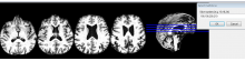 MRIcron_MultiSliceMode.png (282×1 px, 195 KB)